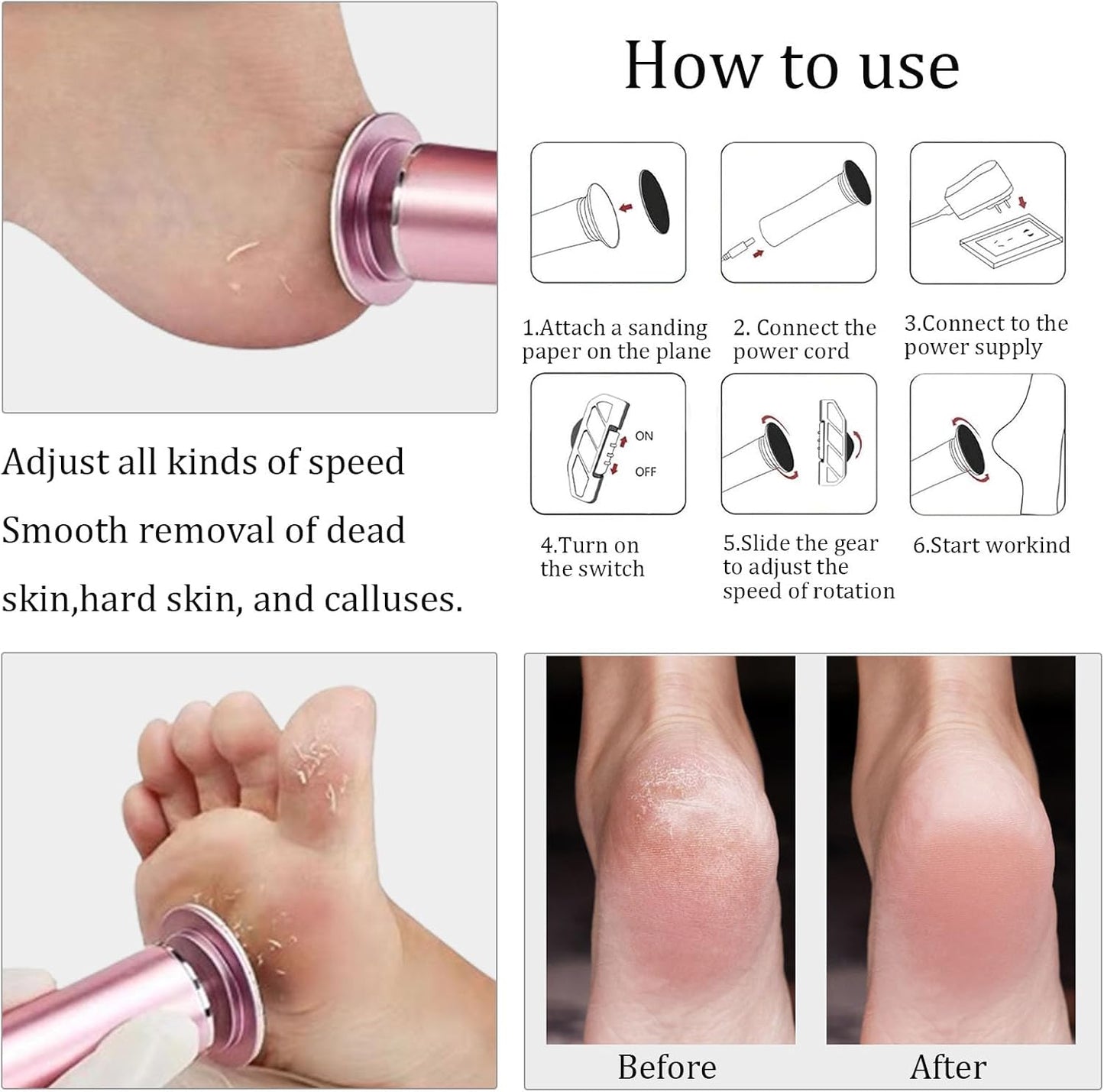 SmoothStep™ Foot care New Electric Callus Remover